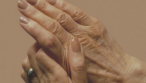 Reumatoidni artritis otežava začeće