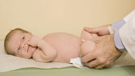 Razvojni poremećaj kuka u dojenčadi