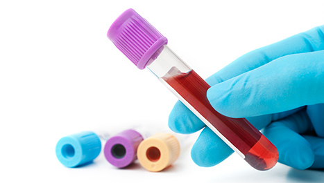 Testiranja na HIV i virusne hepatitise