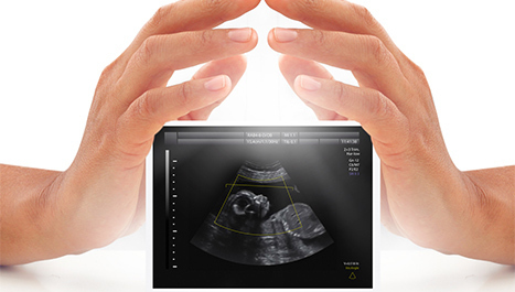 Ultrazvuk ukazuje na prerani porod