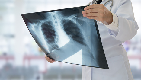KB Dubrava: Smrtnost pacijenata na respiratoru 68%