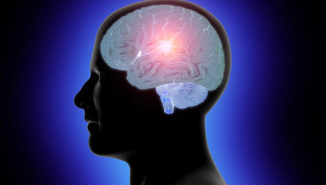 Prevencija posljedica moždanog udara 