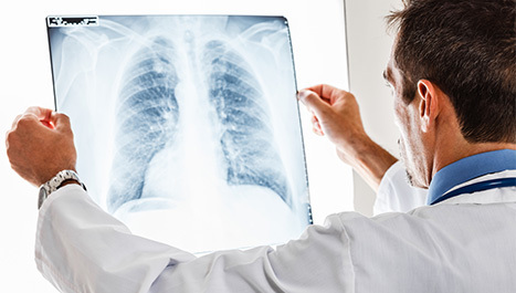 Kako dijagnosticirati astmu?