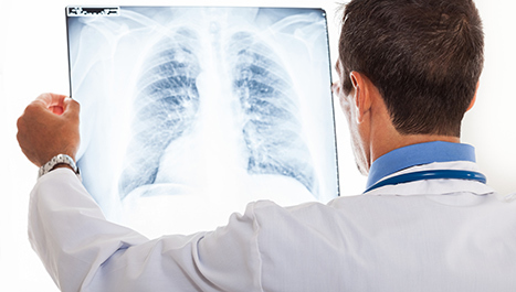 Povećanje učestalosti plućnih bolesti
