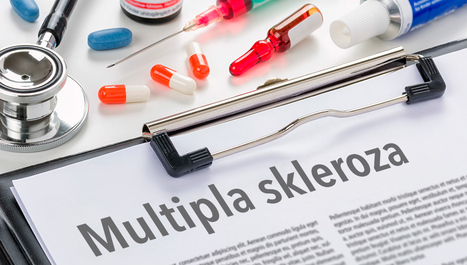 Kako liječenje utječe na razvoj multiple skleroze