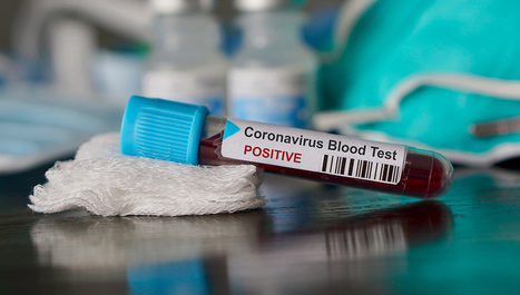 Cijepljenje znatno manje rizično od zaraze koronavirusom