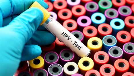 HPV infekcija – simptomi, liječenje i cijepljenje