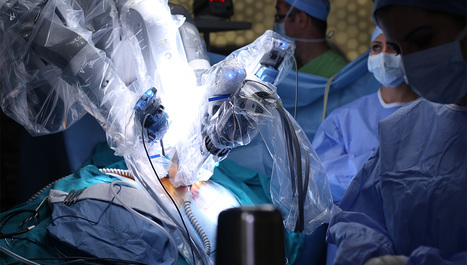 Robotska i otvorena radikalna operacija prostate