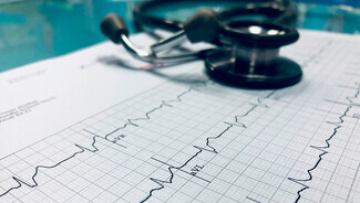 Elektrostimulacija srca u liječenju aritmija srca