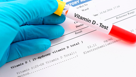 Multipla skleroza i vitamin D